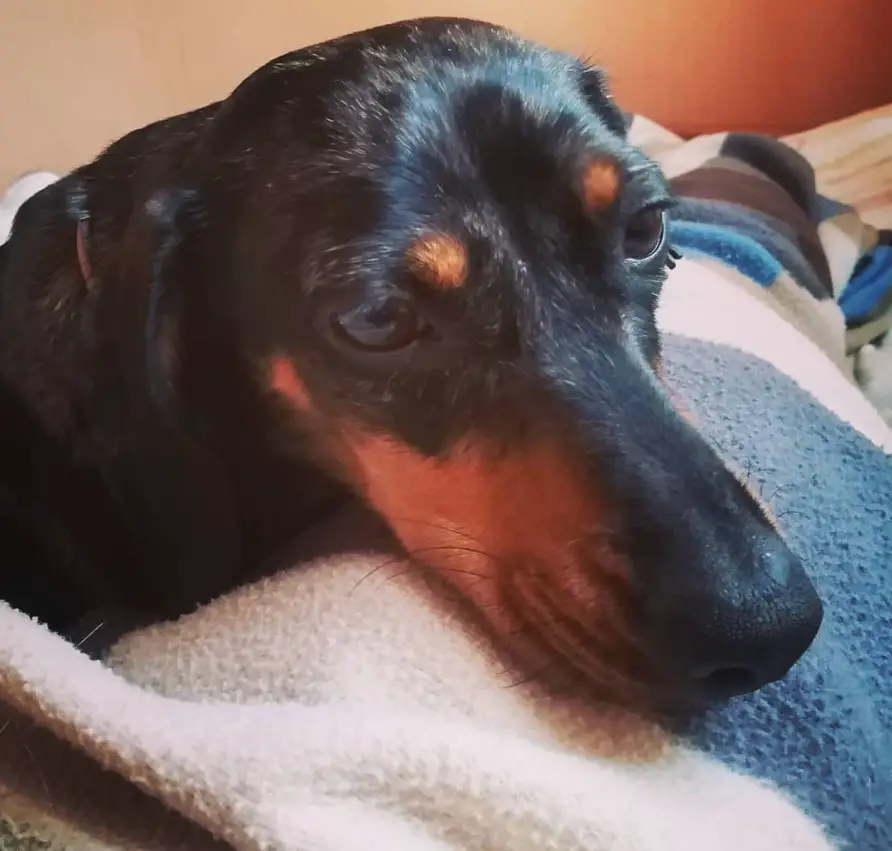 A Dachshund lying on the bed with its sad face