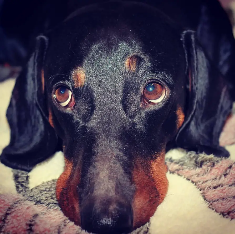 A Dachshund lying on the bed with its sad face
